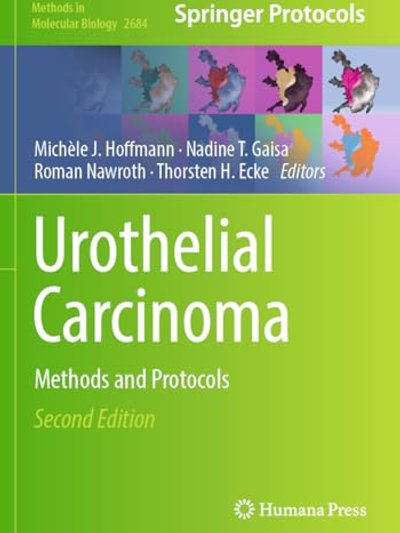 Urothelial Carcinoma